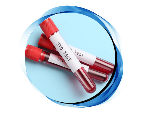STD Testing in Houston